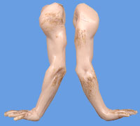 Arms (straight)